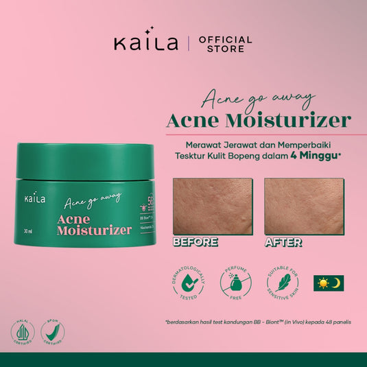KAILA ACNE GO AWAY- ACNE MOISTURIZER 30ML